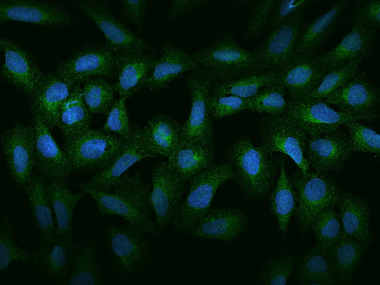 CTSA / Cathepsin A Antibody