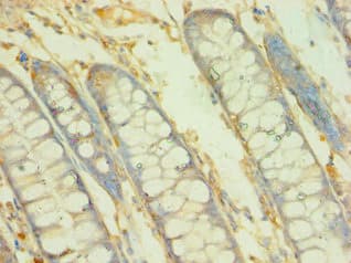 BCAT2 Antibody (aa20-200)