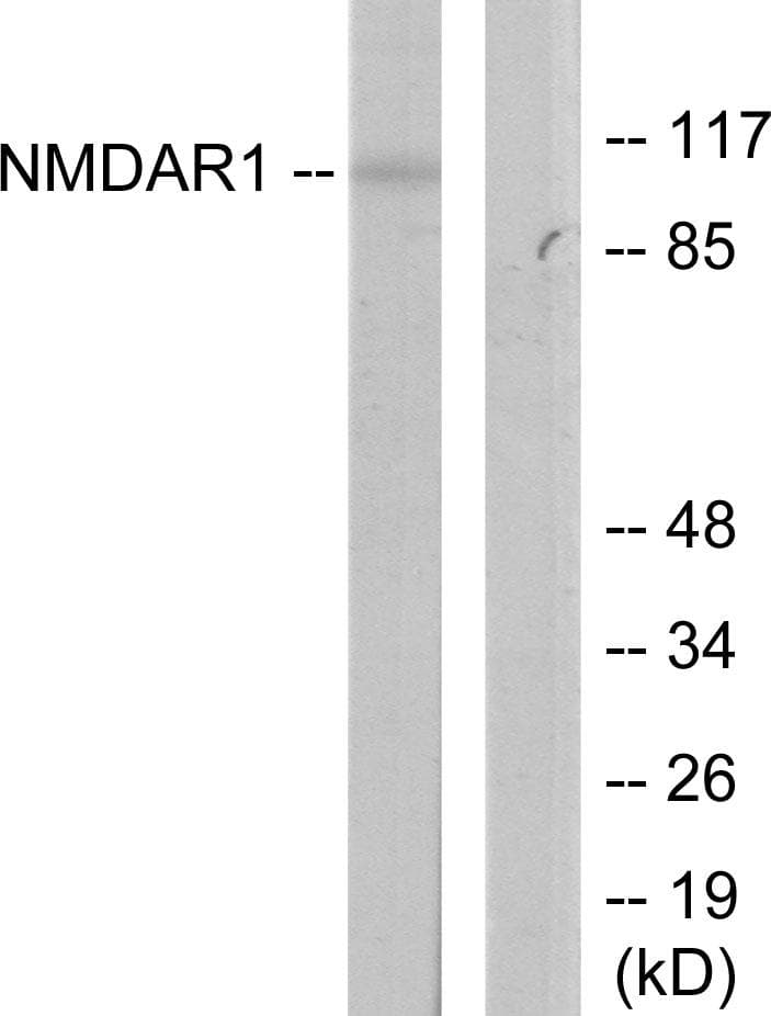 GRIN1 / NMDAR1 Antibody (Ser897)