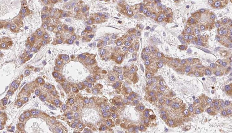 CCR4 Antibody (aa1-48)