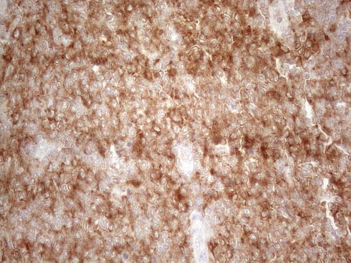 PLCXD1 Antibody (clone OTI2D7)
