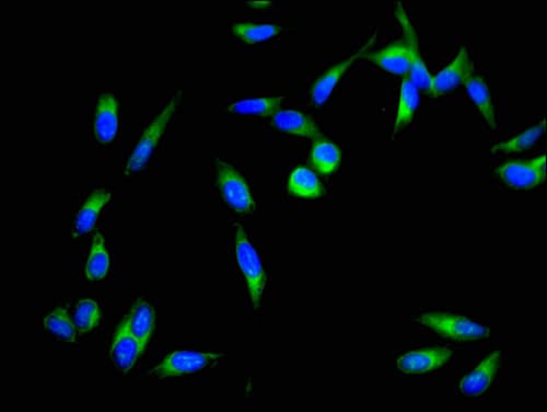 Polyclonal Rabbit anti-Human DAPK3 / ZIP Kinase Antibody (IF, WB)