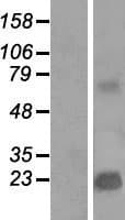 TMEPAI / PMEPA1 Protein (Over-Expression Lysate Myc-DDK (Flag))