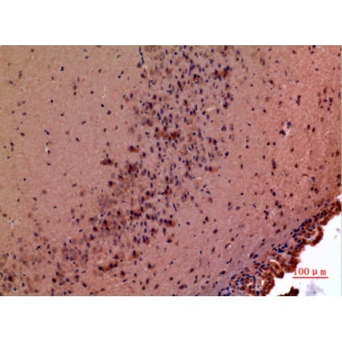 GDF5 / GDF-5 Antibody (351-400 aa, Internal)