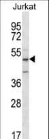 ABI2B / ABI2 Antibody (aa1-30)
