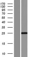 RPS9 / Ribosomal Protein S9 (Over-Expression Lysate Myc-DDK (Flag))