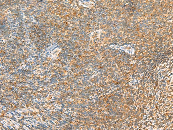 MTHFD2L Antibody