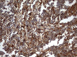CD99 Antibody (clone OTI5C1)