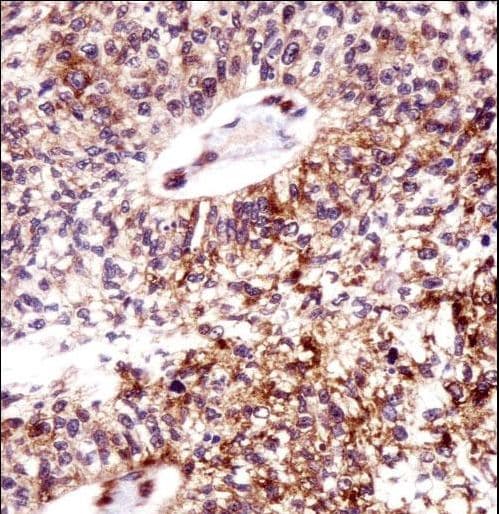 ECT2 Antibody (aa597-625)