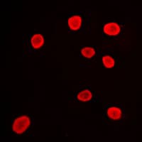 Polyclonal Rabbit anti-Human HDAC9 Antibody (C-Terminus, IHC, IF, WB)