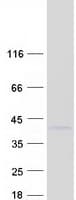 Human PPP1CB Protein (Recombinant Myc-DDK (Flag))