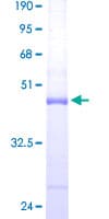 Human ARPC5 / p16-Arc Protein (Recombinant GST)