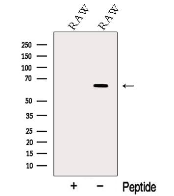TNFRSF11A / RANK Antibody