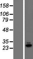 C19orf60 Protein (Over-Expression Lysate Myc-DDK (Flag))