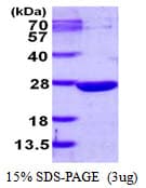 Human DUSP13 Protein (Recombinant His)