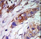 MAPK7 / ERK5 Antibody (aa776-805)