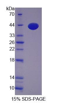 Human KIF2A Protein (Recombinant His-S)