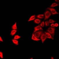 Polyclonal Rabbit anti-Human FZR1 Antibody (IHC, IF, WB)
