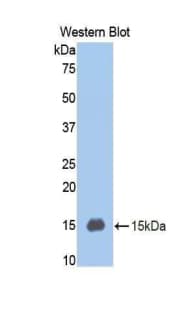 SERPING1 / C1 Inhibitor Antibody (aa406-476, Biotin)