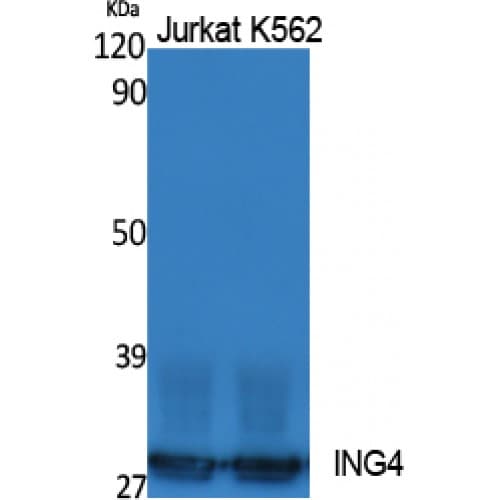 ING4 Antibody (Internal)