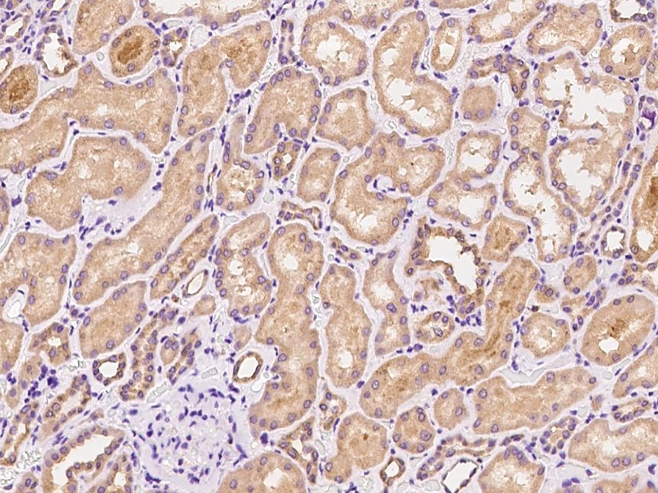 ZCCHC4 Antibody