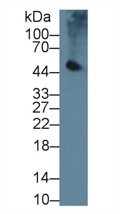 PNLIP / PL / Pancreatic Lipase Antibody (aa201-412)