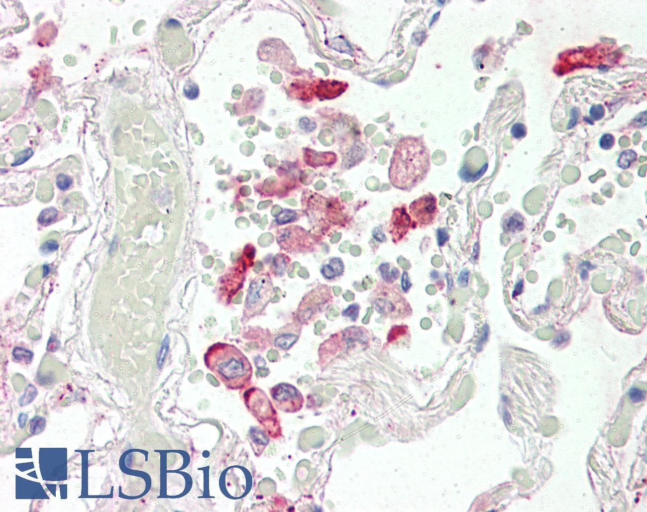 IHC-plus™ Carboxylesterase 1 / CES1 Antibody (aa533-544)