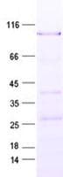 Human HIC2 Protein (Recombinant His, N-Terminal)