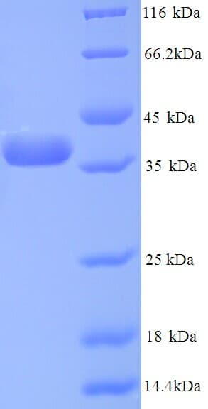 Human ANXA5 / Annexin V Protein (Recombinant His)