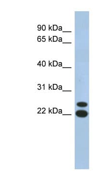 C19orf54 Antibody (N-Terminus)