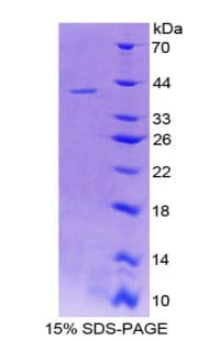 Rat SERPINB1 Protein (Recombinant His-T7)