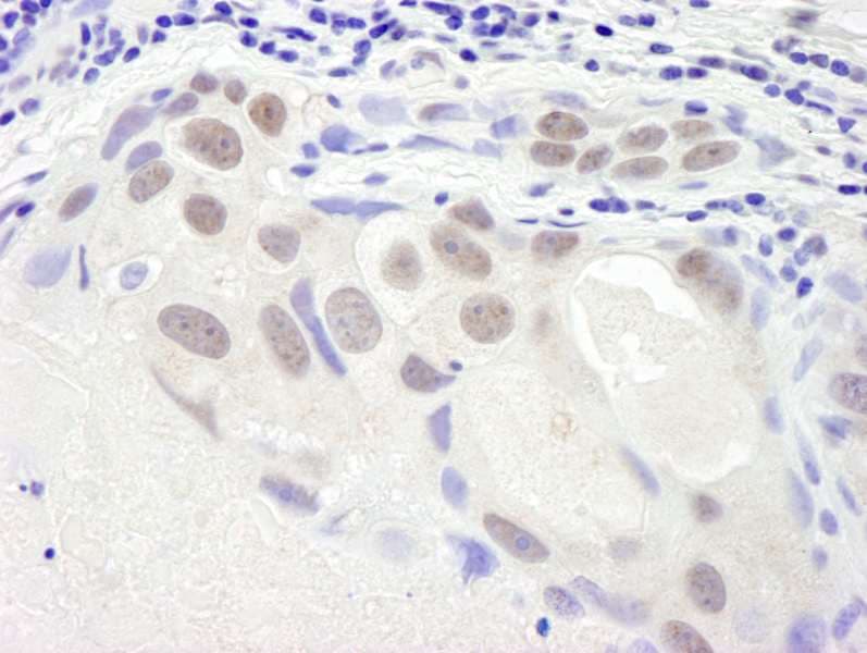 Polyclonal Rabbit anti-Human SMC6 Antibody (aa1050-C-term, IHC)