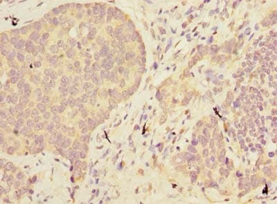 ABHD2 Antibody