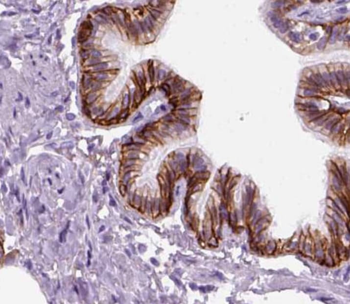 Polyclonal Rabbit anti-Human AQP3 / Aquaporin 3 Antibody (IHC, WB)