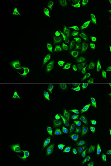 Polyclonal Rabbit anti-Human CSNK1A1L Antibody (IHC, IF, WB)
