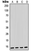 Polyclonal Rabbit anti-Human PVALB / Parvalbumin Antibody (Internal, WB)