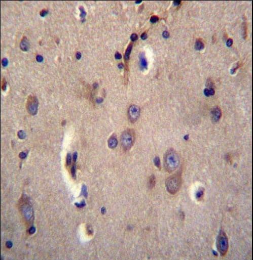 Polyclonal Rabbit anti-Human DTNA / Dystrobrevin Alpha Antibody (aa692-721, IHC, IF, WB)