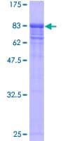 Human VCP Protein (Recombinant GST)