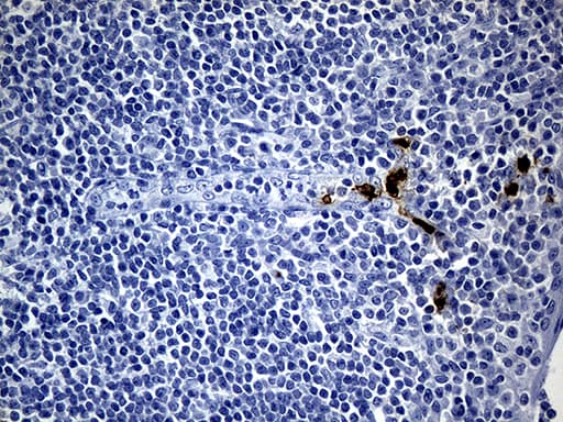 FOXO1 / FKHR Antibody (aa356-655, clone OTI2B5, Carrier-free)