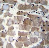 CTSK / Cathepsin K Antibody (aa97-126)