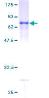 Human PDCL Protein (Recombinant GST)