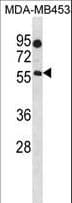 B4GALNT1 / GM2/GD2 Synthase Antibody (aa296-323)