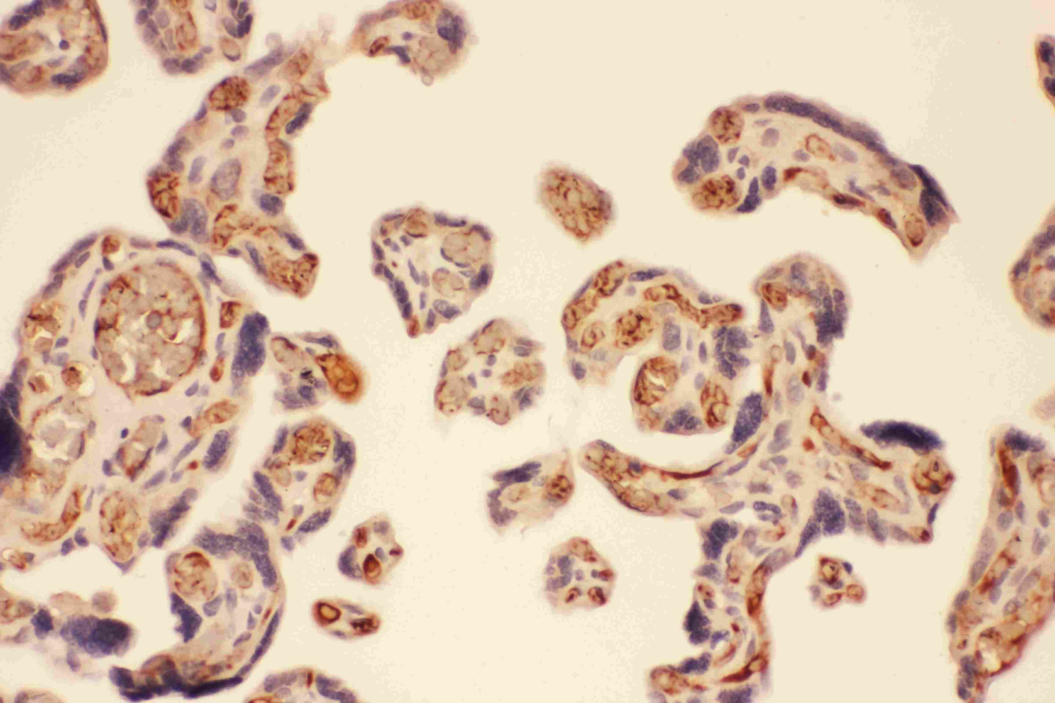 Polyclonal Rabbit anti-Human MMP7 / Matrilysin Antibody (aa1-267, IHC, WB)