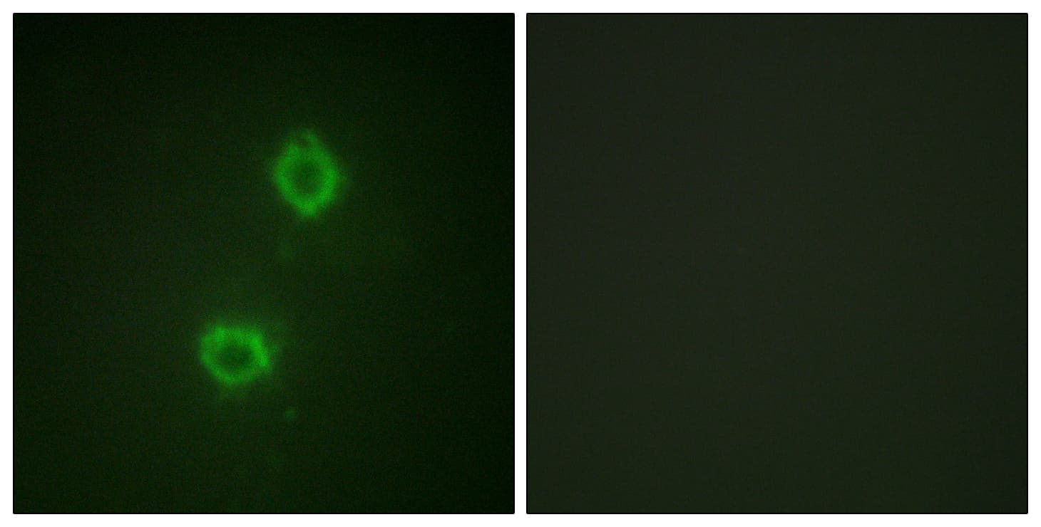 FGFR1 / FGF Receptor 1 Antibody (aa626-675)