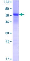 Human NPM1 / NPM / Nucleophosmin Protein (Recombinant GST)
