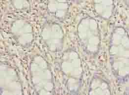Polyclonal Rabbit anti-Human TMEM154 Antibody (IHC, WB)