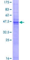 Human TMEM9 Protein (Recombinant GST)