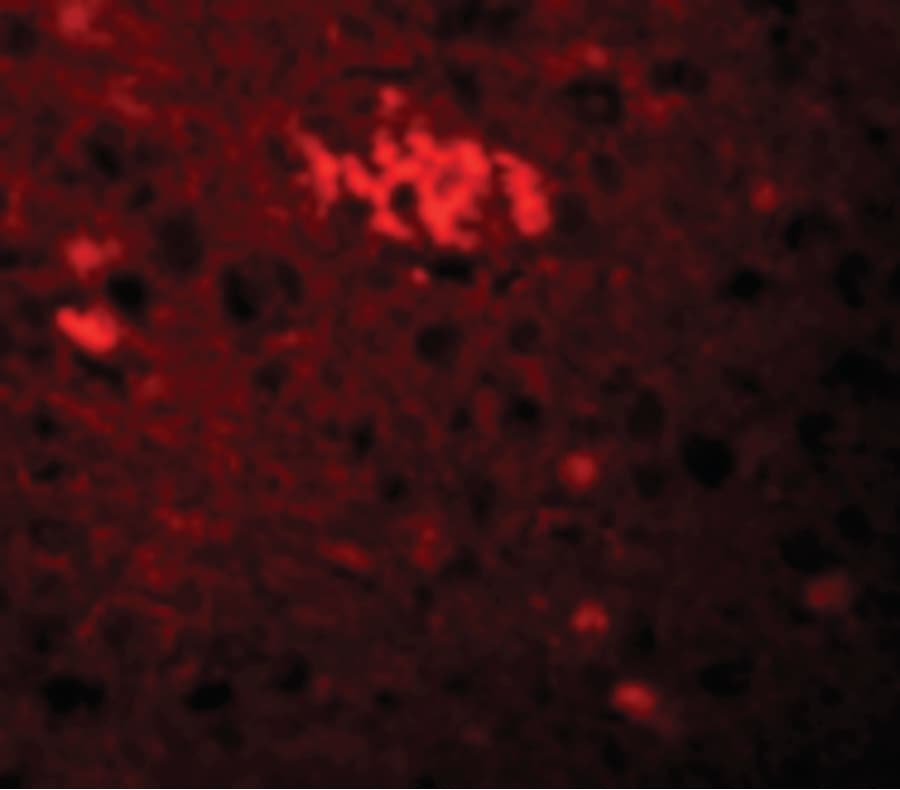 Polyclonal Rabbit anti-Human LIN41 / TRIM71 Antibody (IHC, IF, WB)
