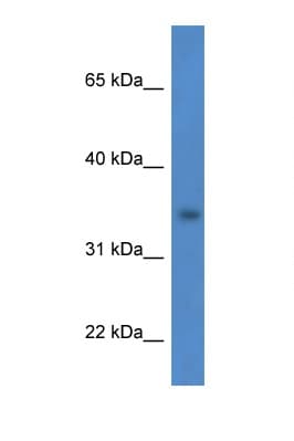 HSDL1 Antibody (aa98-147)