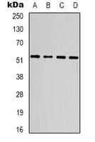 Monoclonal Mouse anti-Human SMAD3 Antibody (IHC, WB)